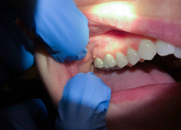Best Emergency Root Canal Treatment in Mulberry, AR