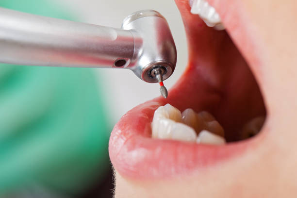 Best Emergency Dentist for Knocked-Out Tooth in Mulberry, AR